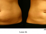 lower-ab-3-a
