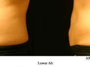 lower-ab-3-c