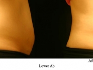 lower-ab-3-d