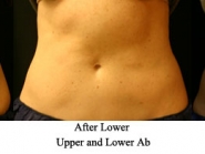 upper-lower-ab-1