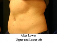 upper-lower-ab-2