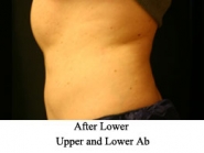 upper-lower-ab-3