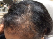Female Before and After