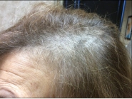 Female Before and After