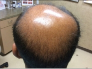 Male Before and After