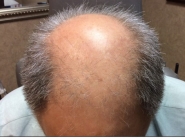 Male Before and After