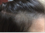 Female Before and After