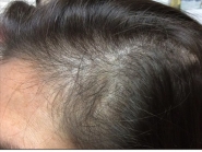 Female Before and After