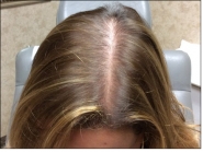 Female Before and After