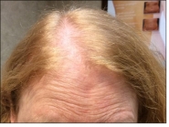 Female Before and After