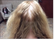 Female Before and After
