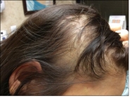 Female Before and After
