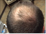 Male Before and After