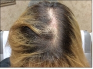 Female Before and After