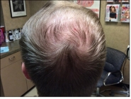 Male Before and After