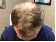 Male Before and After