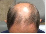 Male Before and After