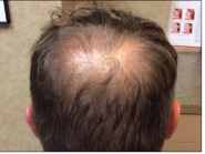 Male Before and After