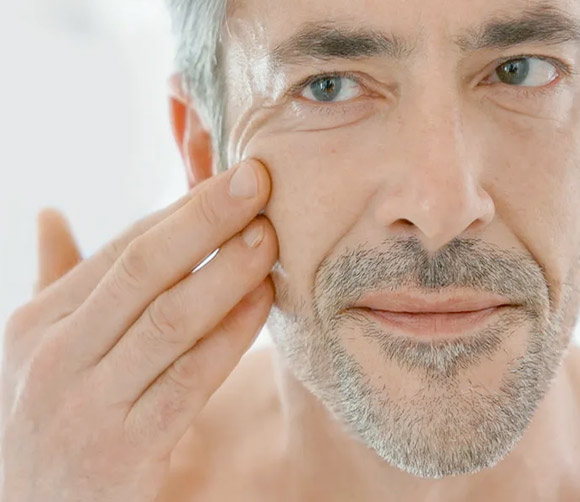 Juvederm Voluma